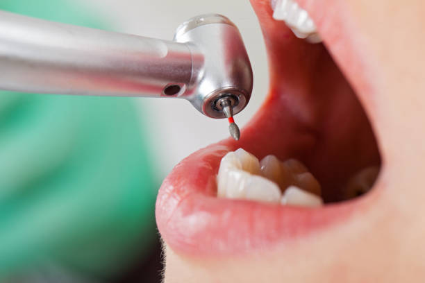 Best Broken Tooth Emergency  in Morgan City, LA